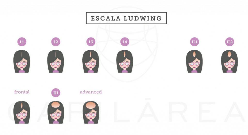 Escala-Ludwing