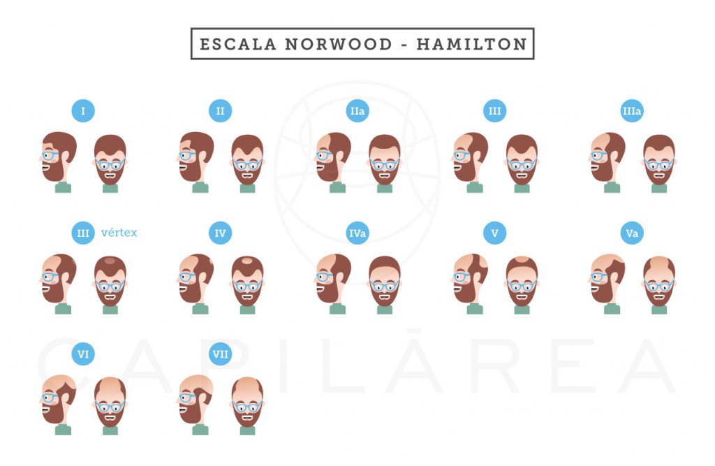 Escala Norwood Hamilton