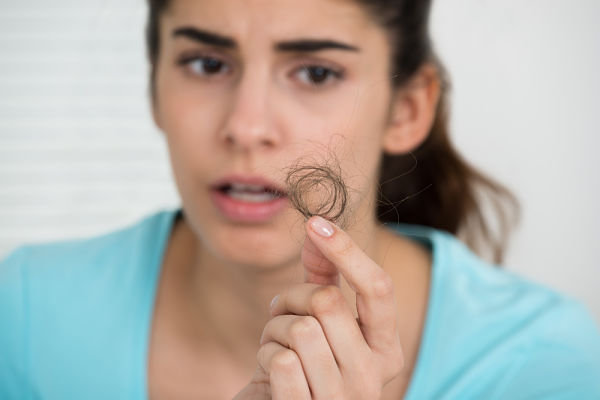 Mujer con alopecia femenina y fuerte caída del pelo