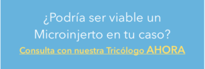 microinjerto consulta