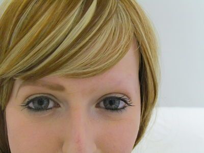 tratamiento para alopecia en cejas