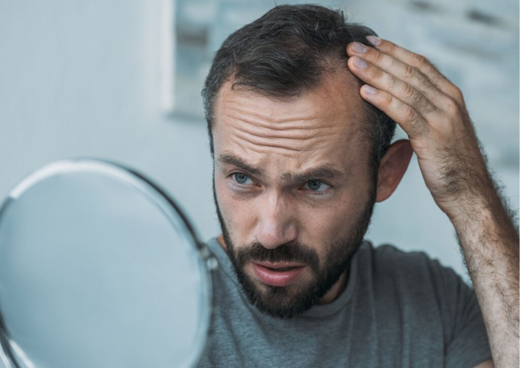 Se me cae el pelo hombre