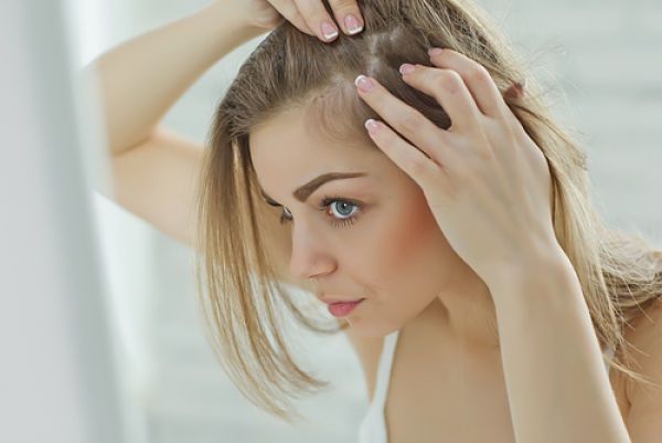 Cómo se diagnostica la alopecia en mujeres