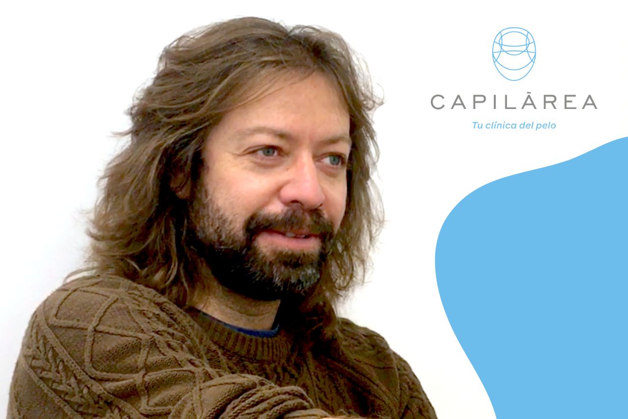 caída del pelo entrevista paciente Capilárea