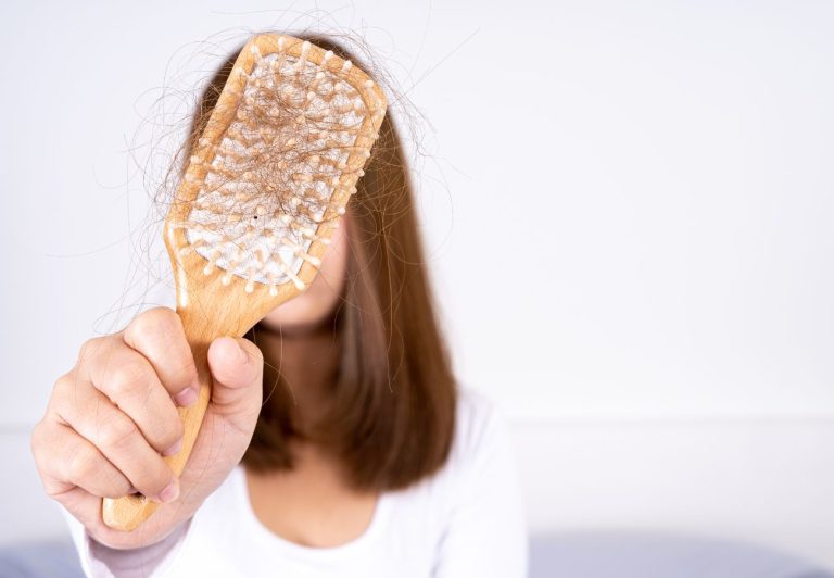 cómo saber si tengo alopecia