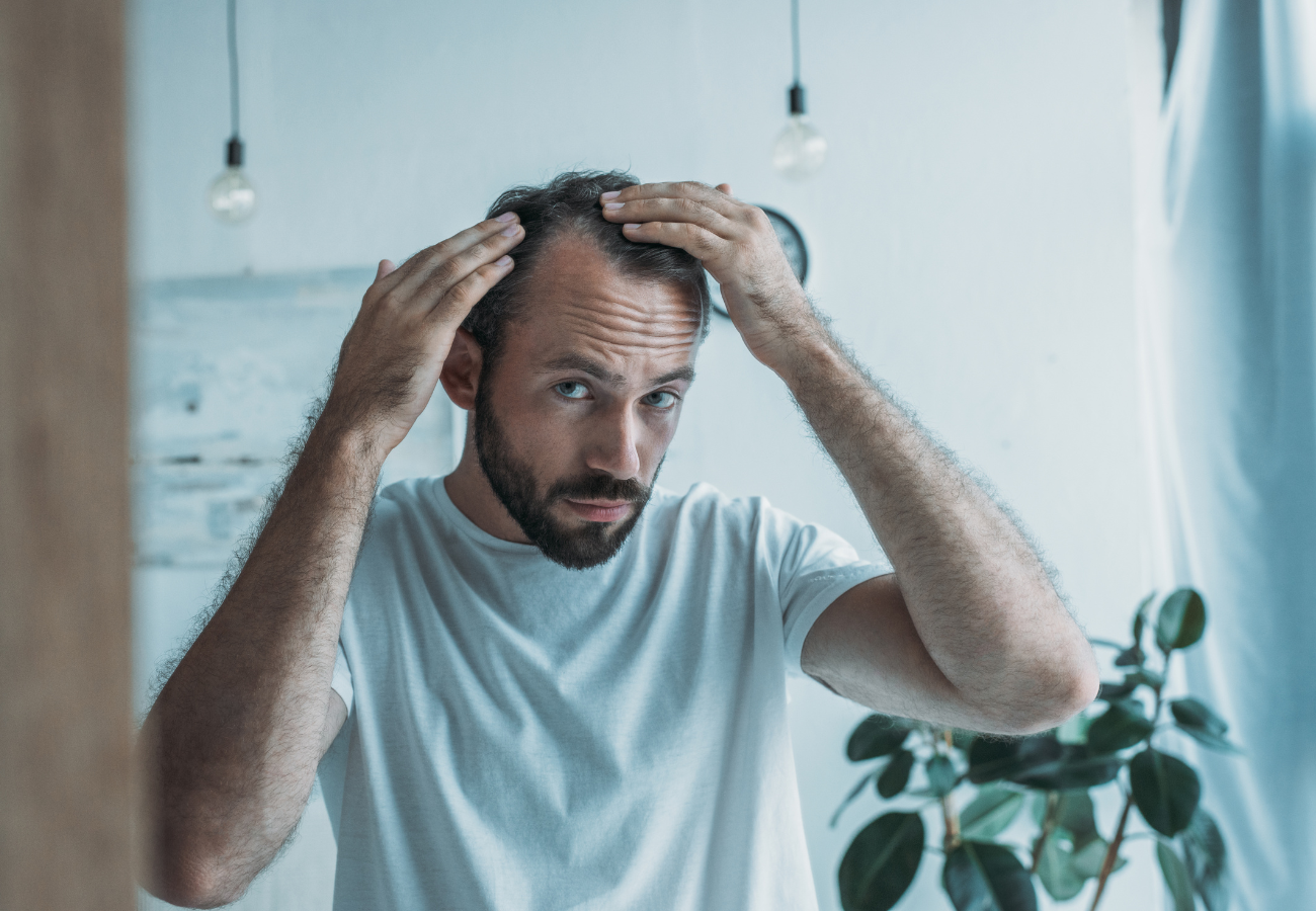 a qué edad se les cae el pelo a los hombres