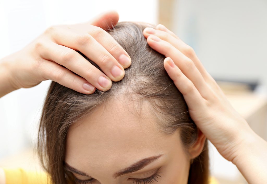Caída del pelo