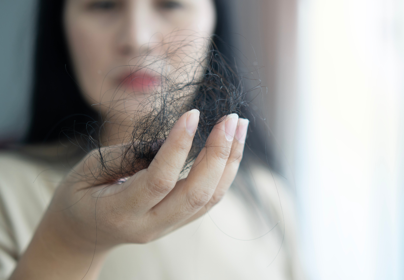 Caía de pelo estacional