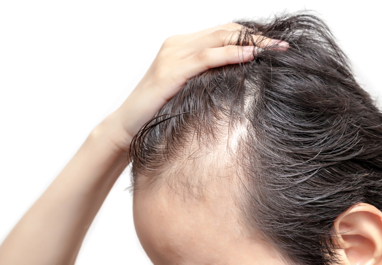 pelo fino en hombres
