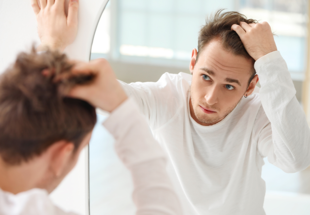 alopecia prematura en jóvenes y adolescentes